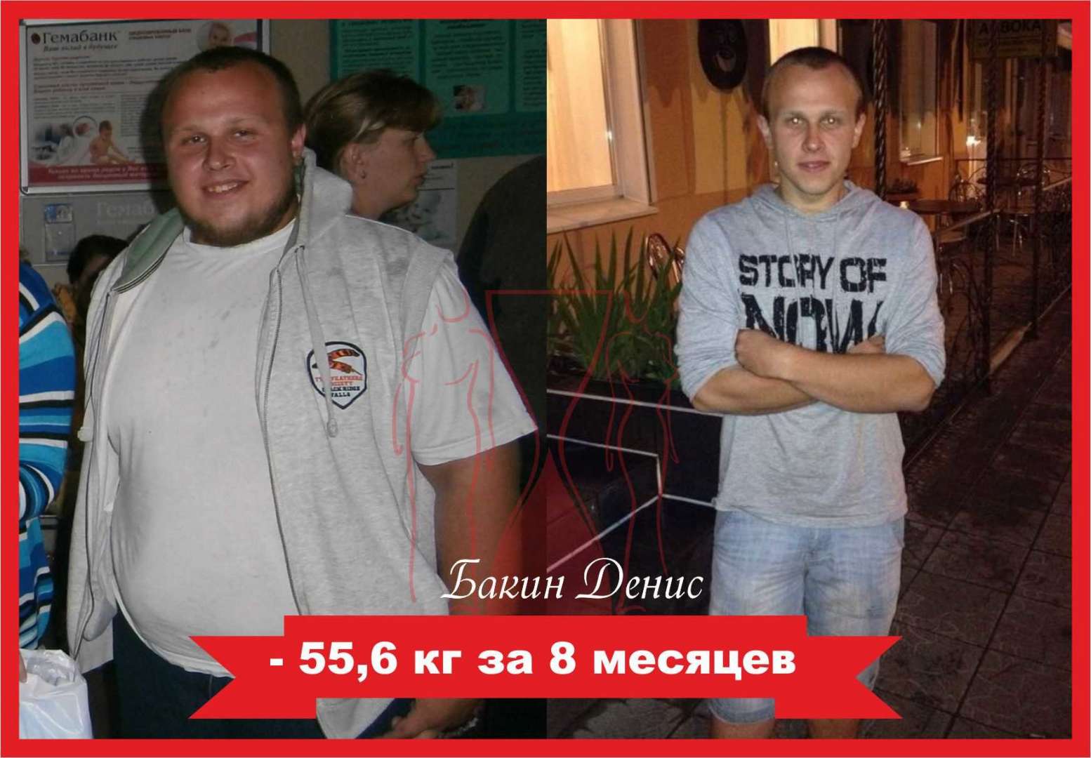 Клиника Для Похудения